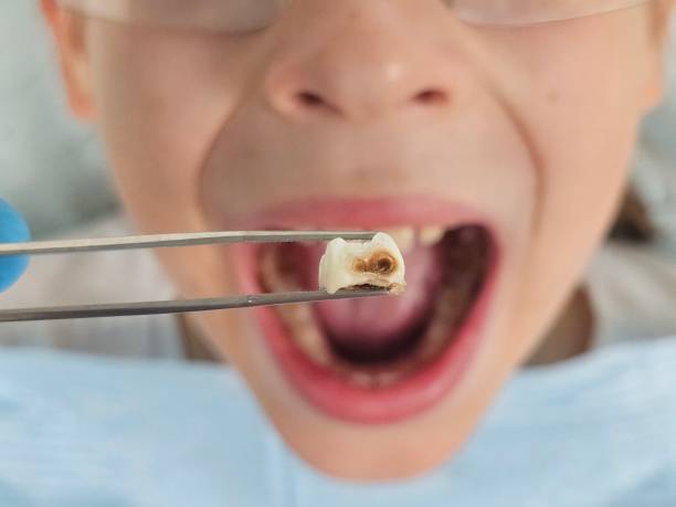 Best Cracked Tooth Emergency Dentist  in Quakertown, PA
